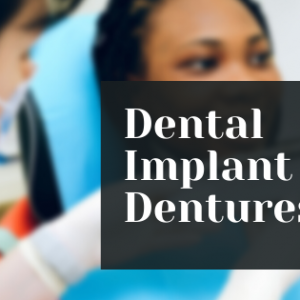 Dental Implant Dentures er