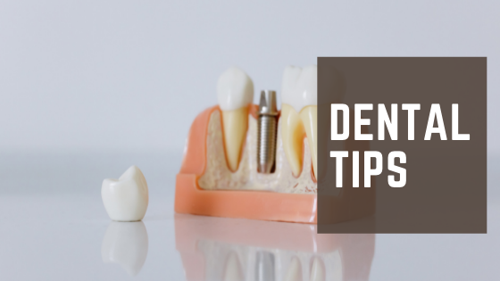 Dental Tips njfg