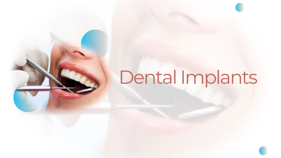 Implant-Supported Dentures vs. Dental Implants: